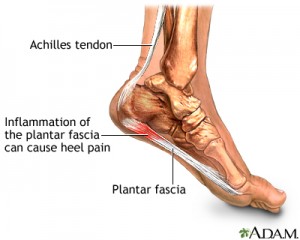 plantar fasc3